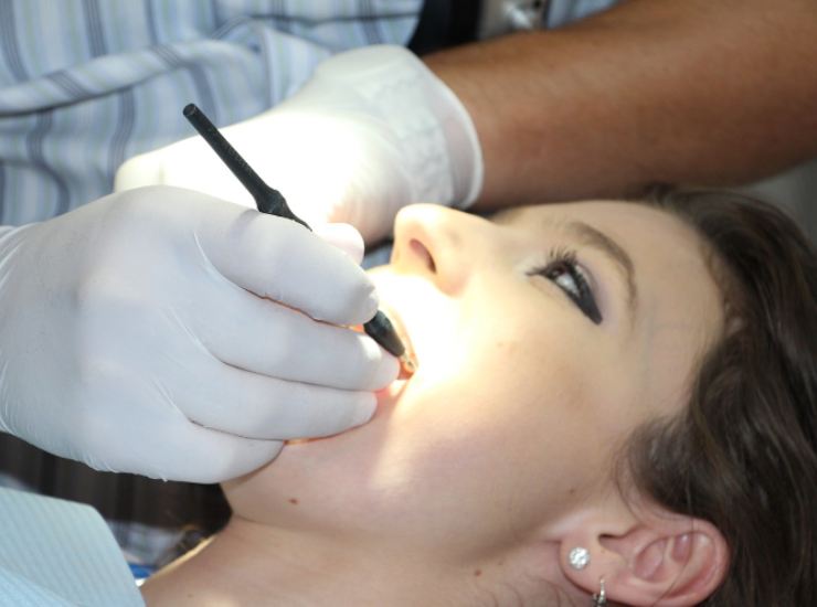 Come prendersi cura dei denti